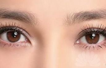 女子双眼皮手术四年半后意外揉出手术针，医疗安全与术后护理的重要性