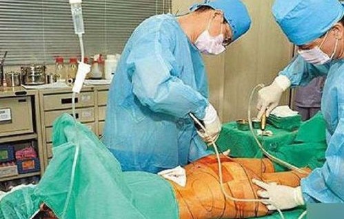 33岁网红疑因抽脂手术不幸离世，美丽背后的风险与警醒