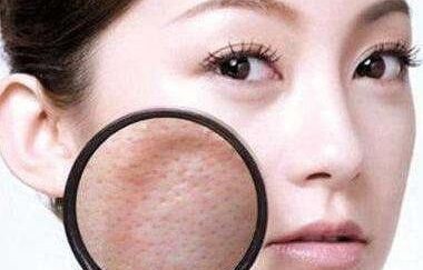 女子头痛频发，竟因鼻子发霉之谜