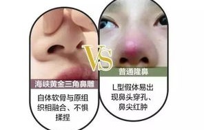 21岁女孩因隆鼻手术意外离世，警惕整形手术风险