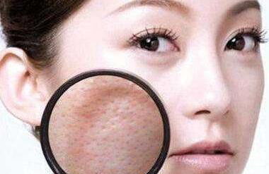 女子头痛频发，竟因鼻子发霉之谜