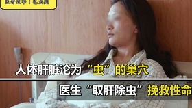 全球首例同时换脸换手男子喜结良缘 全球首例同时换脸换手男子喜结良缘