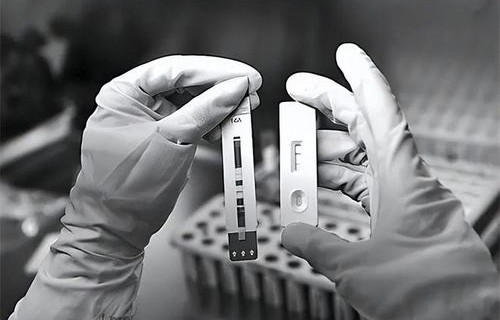 艾滋夫妇确诊感染后的第20年