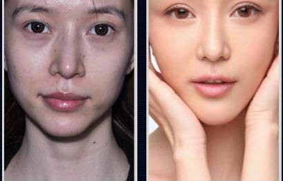 探究人老后鼻子为何会变大的原因