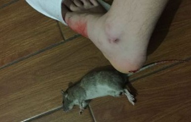 女子徒手揪老鼠尾巴遭遇反咬，警惕生活中的小动物威胁