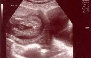 准爸爸手拿宝宝B超单的压岁钱大冒险