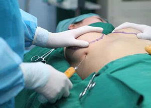 十二岁女孩误诊,月经不调背后的癌症阴影 十二岁女孩误诊,月经不调背后的癌症阴影